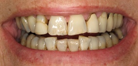 before and after images