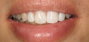 before and after images