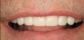 before and after images