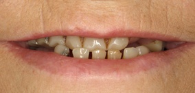 before and after images