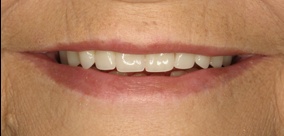 before and after images