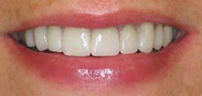 before and after images