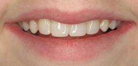 before and after images