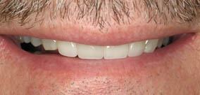 before and after images