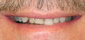 before and after images