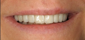 before and after images