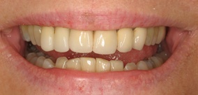 before and after images