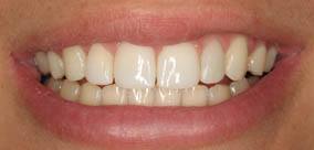before and after images