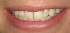 before and after images